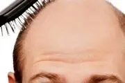 رفت و آمد زیاد کچل ها به این آرایشگاه دست آقای آرایشگر را رو کرد!

