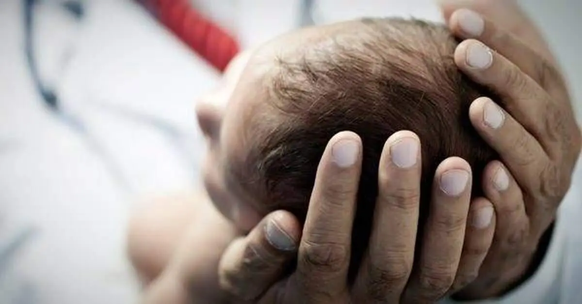 تصویری ترسناک و غم انگیز از کودک بدون دست و پا و بینی