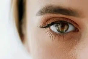 نابودی سیاهی دور چشم در سه سوت