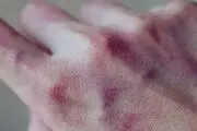 جزئیات ماجرای ضرب و شتم سالمند در سرای سالمندان سنندج