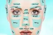 به کمک محل جوش صورتتان، بیماری هایتان را پیدا کنید
