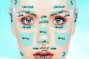 به کمک محل جوش صورتتان، بیماری هایتان را پیدا کنید