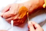 به این دلایل روی زخم بتادین نریزید