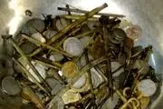 خارج کردن 2 کیلوگرم فلز از شکم مرد آشغال خور + عکس