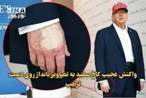 واکنش کاخ سفید به تصاویر بانداژ روی دست ترامپ + ببینید 