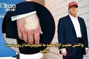 واکنش کاخ سفید به تصاویر بانداژ روی دست ترامپ + ببینید 