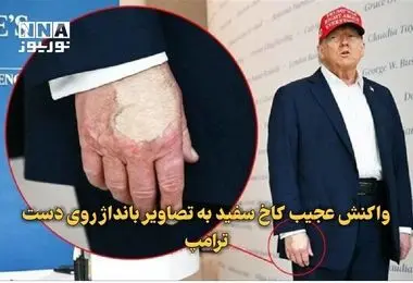 واکنش کاخ سفید به تصاویر بانداژ روی دست ترامپ + ببینید 