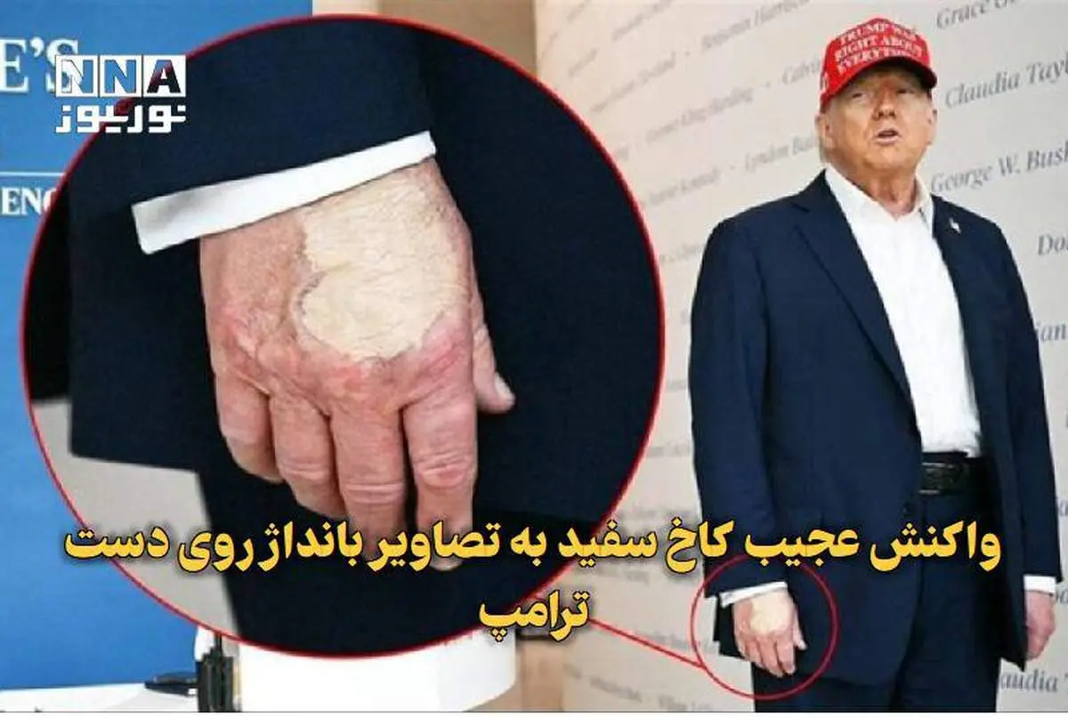 واکنش کاخ سفید به تصاویر بانداژ روی دست ترامپ + ببینید 