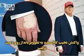 واکنش کاخ سفید به تصاویر بانداژ روی دست ترامپ + ببینید 
