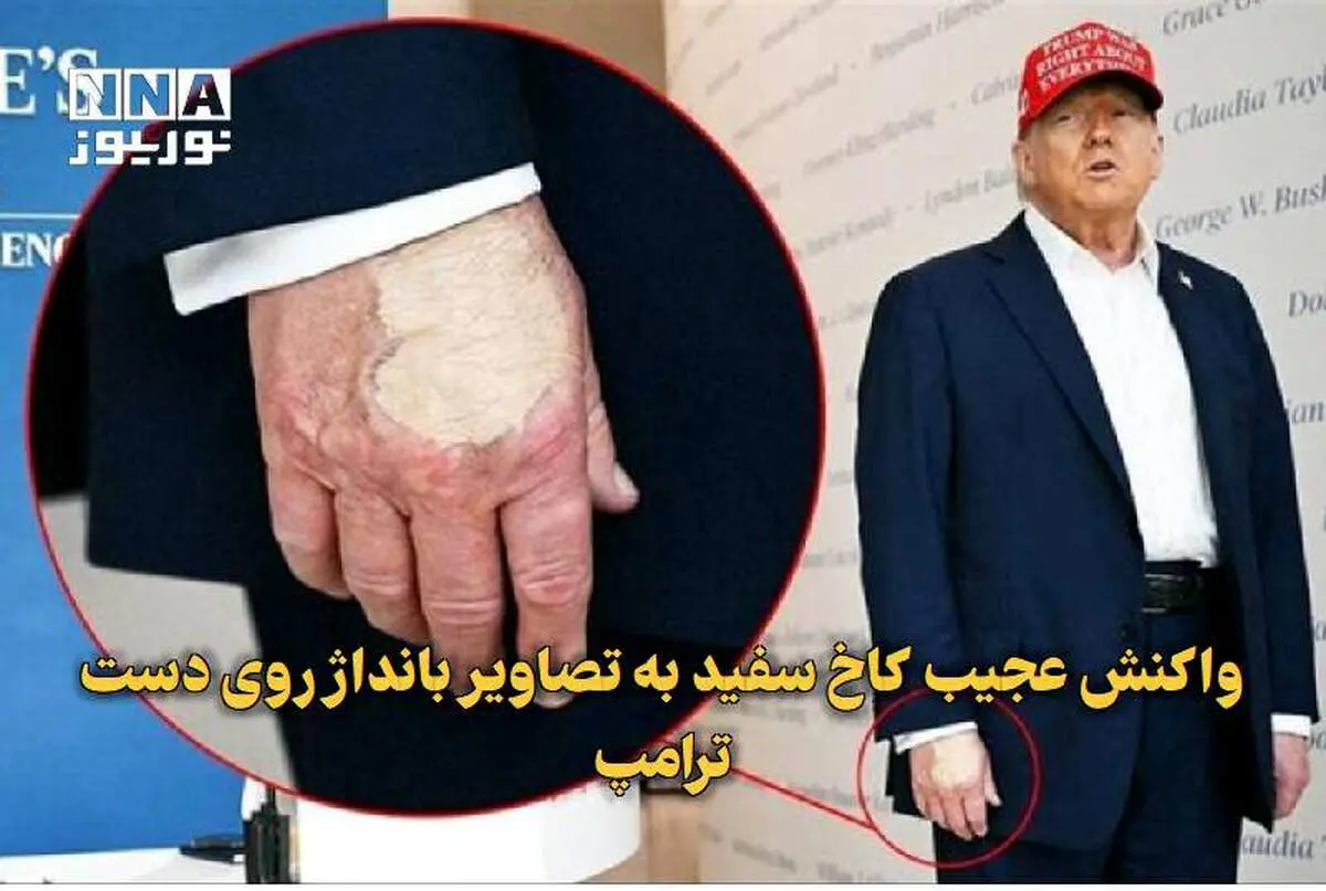 واکنش کاخ سفید به تصاویر بانداژ روی دست ترامپ + ببینید 