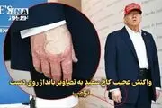 واکنش کاخ سفید به تصاویر بانداژ روی دست ترامپ + ببینید 