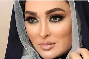 الهام حمیدی دوباره جوان شد/ تغییر بعد از عمل