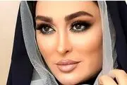 الهام حمیدی دوباره جوان شد/ تغییر بعد از عمل