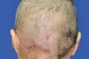 پوست سر این زن بخت برگشته به طور کامل کنده شد + عکس