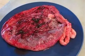 مردی وحشی جفت جنین همسرش را با نمک و فلفل خورد! +عکس چندش‌آور