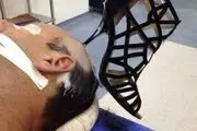 زن عصبانی: شوهرم خیلی حرف میزد پاشنه کفشمو داخل سرش فرو کردم!+عکس