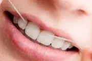 به خاطر این 4 دلیل همیشه قبل از مسواک زدن نخ دندان بکشید!