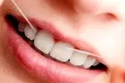 به خاطر این 4 دلیل همیشه قبل از مسواک زدن نخ دندان بکشید!