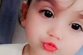 مرگ مرموز و دردناک کودک ۲ ساله در خوزستان+عکس