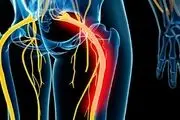 تفاوت بین درد سیاتیک و دیسک
