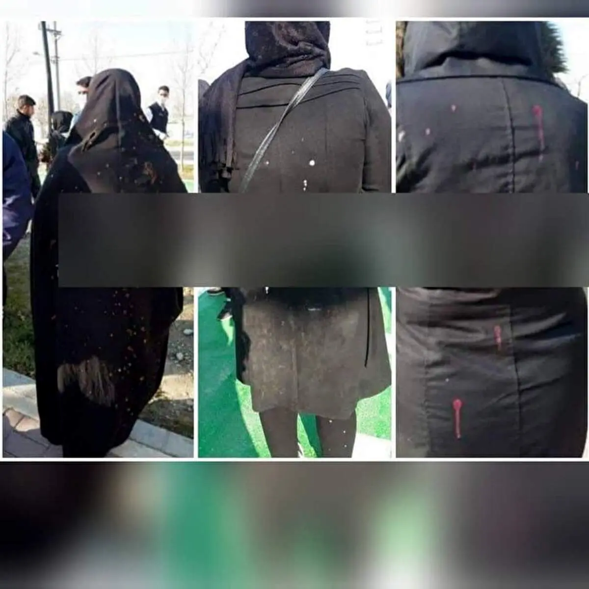 ماجرای هولناک اسیدپاشی روی سه زن در شهریار
