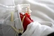 ویروس RSV چیست؟+جزییات
