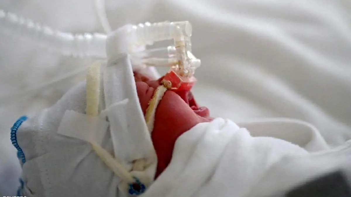 ویروس RSV چیست؟+جزییات
