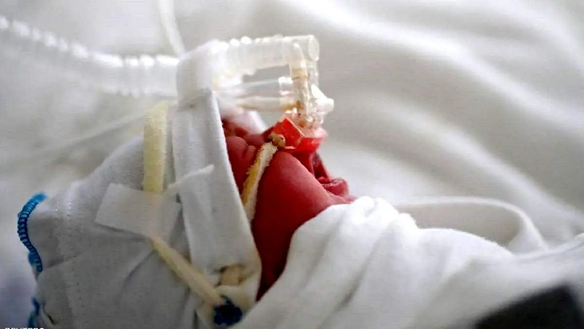 ویروس RSV چیست؟+جزییات
