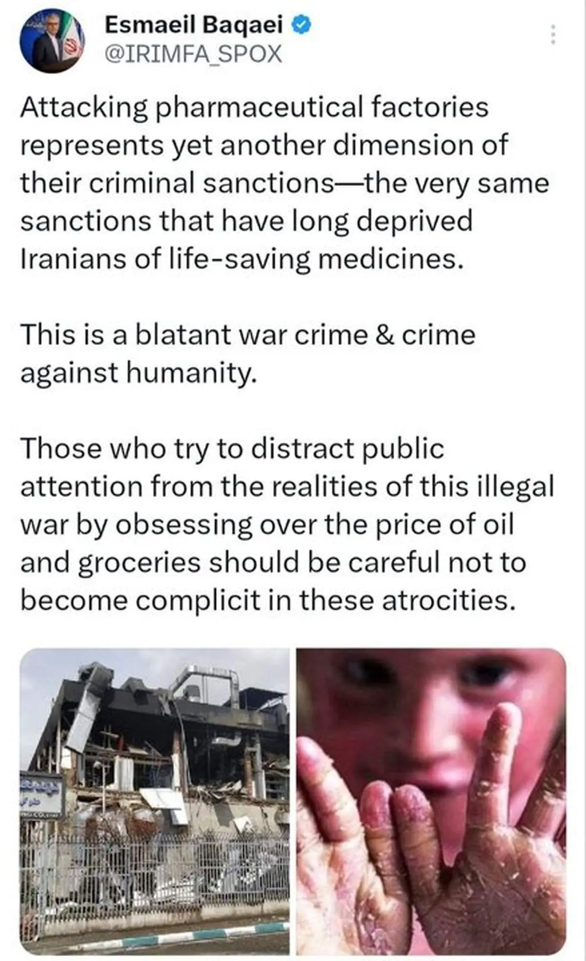 بقائی: حمله متجاوزان به کارخانه‌های داروسازی، جنایت علیه بشریت است