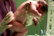 عکسی شوکه کننده از زایمان بیستم این زن جوان/ تصویر

