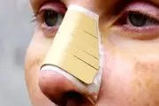 مادر سنگدل بخاطر عمل زیبایی بینی قید بچه‌اش را زد!
