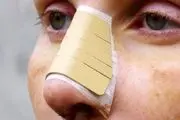 مادر سنگدل بخاطر عمل زیبایی بینی قید بچه‌اش را زد!