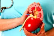 آگهی معاوضه یک کلیه سالم با یک چیز عجیب+ عکس