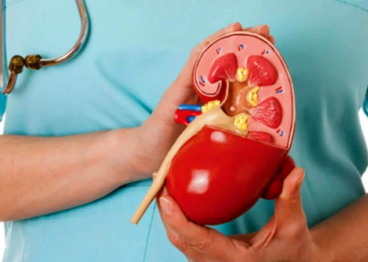 آگهی معاوضه یک کلیه سالم با یک چیز عجیب+ عکس
