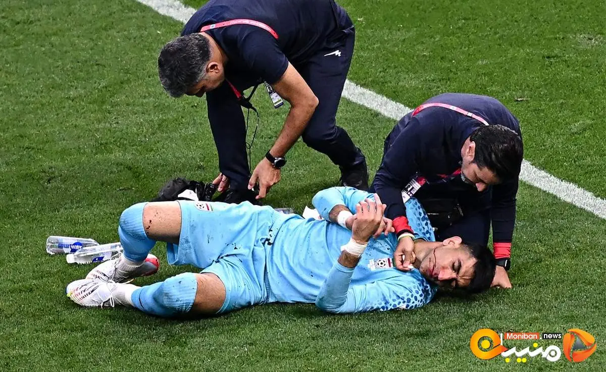 رسما اعلام شد؛بیرانوند جام جهانی را کلا از دست داد