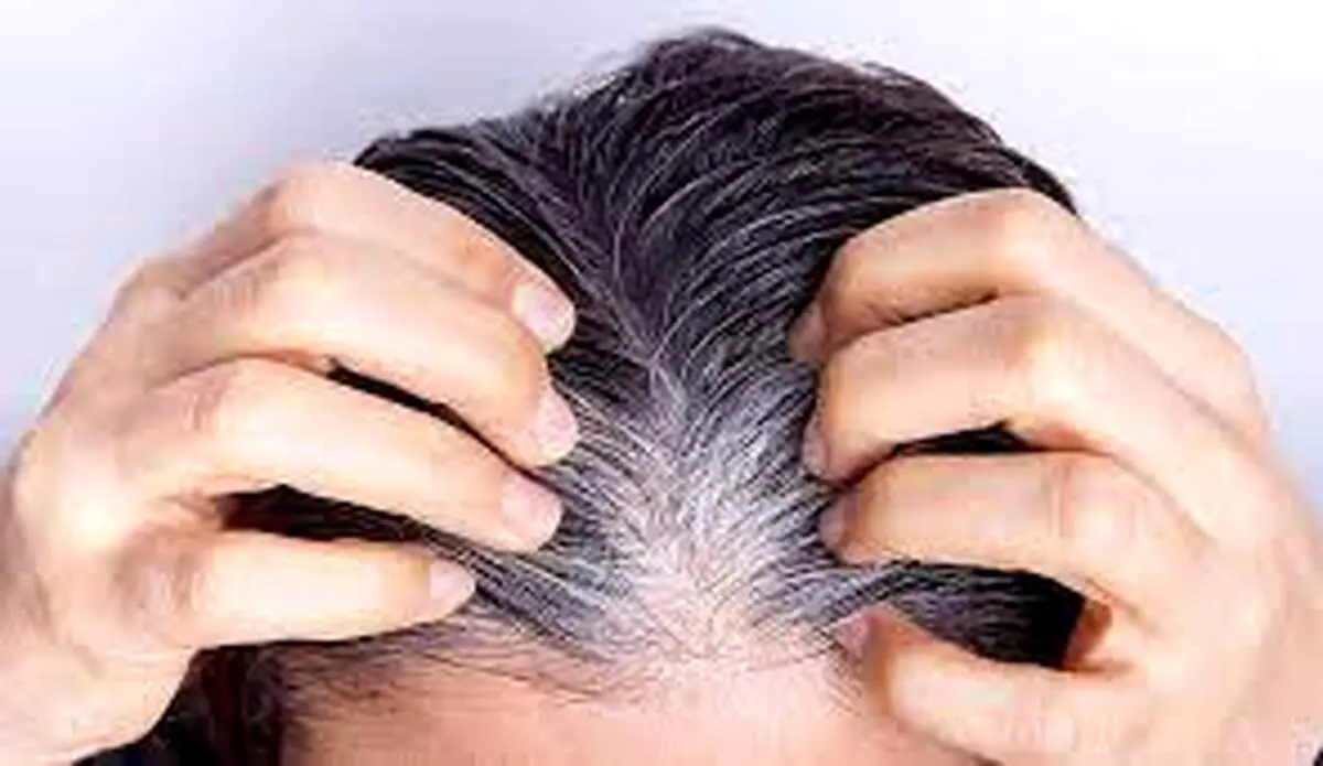 جلوگیری از سفیدی مو با خوردن این خوراکی‌ها!