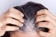 با این روغن موهای سفید خود را سریع سیاه کنید!