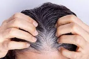جلوگیری از سفیدی مو به همین آسانی