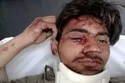 سقوط هولناک دانش آموزی که به دنبال اینترنت بود+ عکس