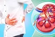 ترکیبات طبیعی برای نابودی سنگ‌های کلیوی
