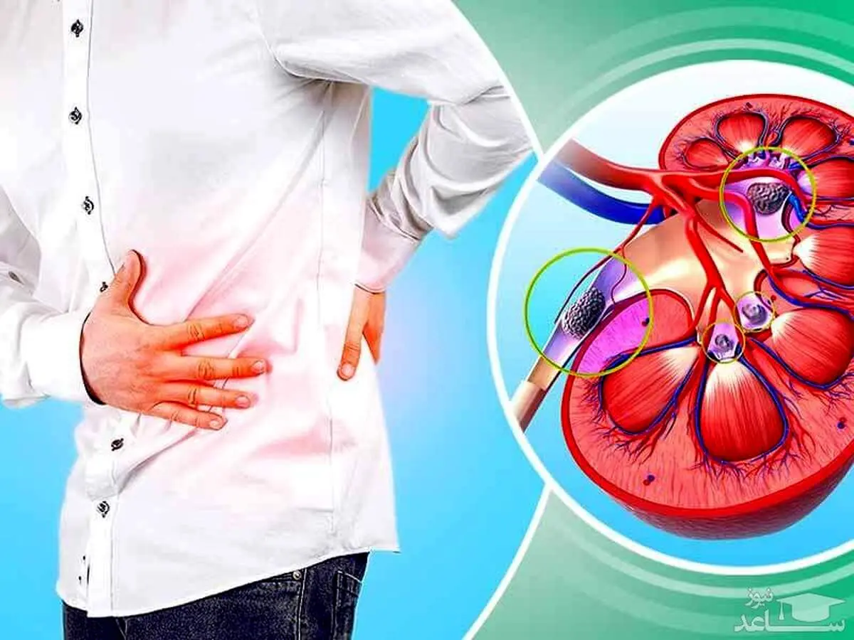 با این موادغذایی کلیه ها را سم زدایی کنید