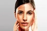راز ها و روش های جالب برای داشتن پوستی صاف و براق