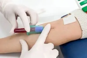هشدار،  این علائم نشان دهنده غلیظ شدن خون است!