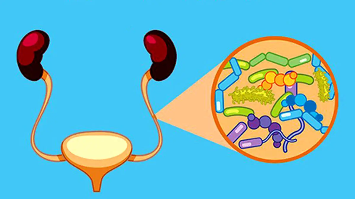 چگونه از عفونت ادراری پیشگیری کنیم؟