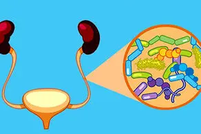 چگونه از عفونت ادراری پیشگیری کنیم؟