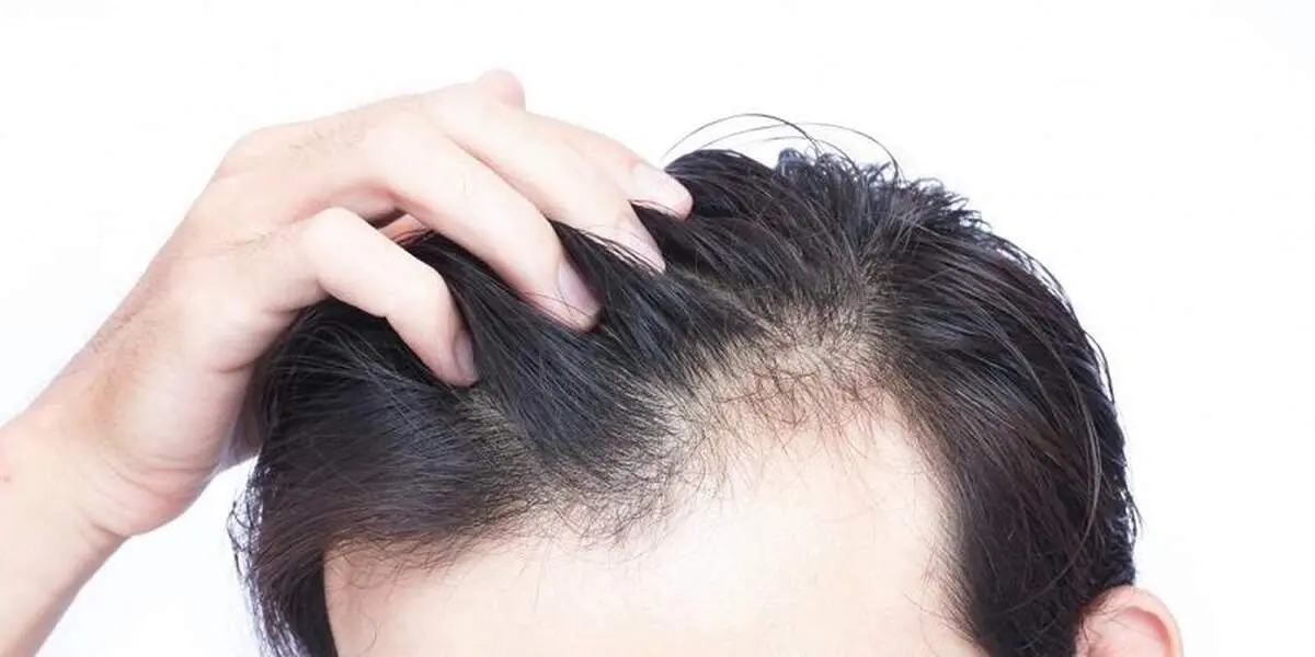 تاثیر عجیب این نوشیدنی بر رشد موهای سر
