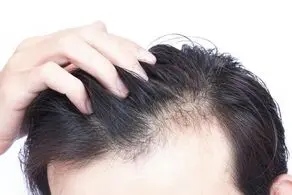 تاثیر عجیب این نوشیدنی بر رشد موهای سر
