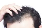 تاثیر عجیب این نوشیدنی بر رشد موهای سر
