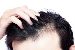 تاثیر عجیب این نوشیدنی بر رشد موهای سر

