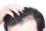 تاثیر عجیب این نوشیدنی بر رشد موهای سر
